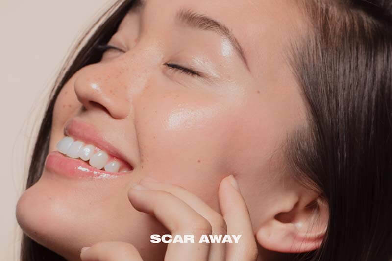 scar away mediwelle
