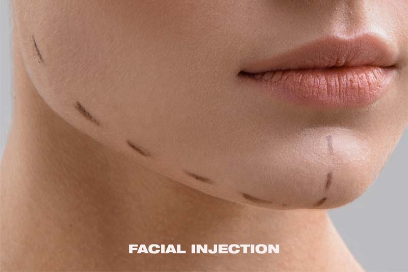 Facial Injection