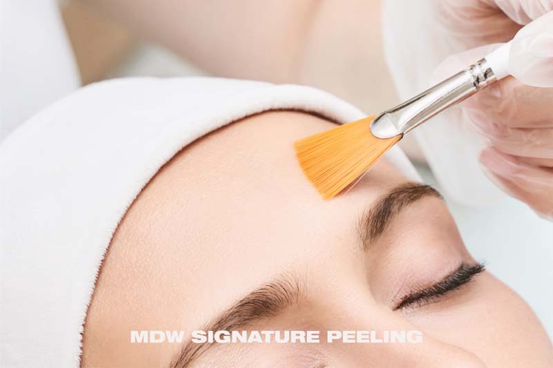 MDW Signature Peeling