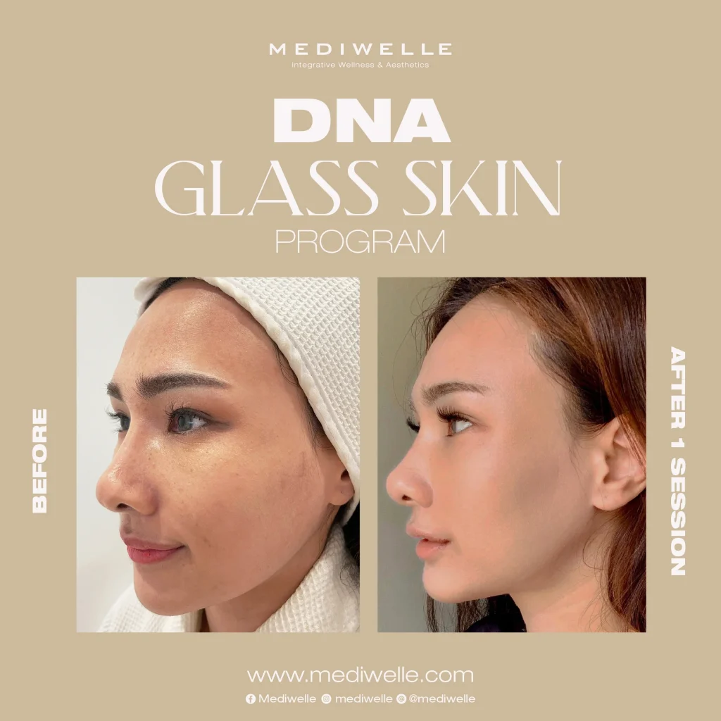 รีวิว DNA Glass Skin - mediwelle