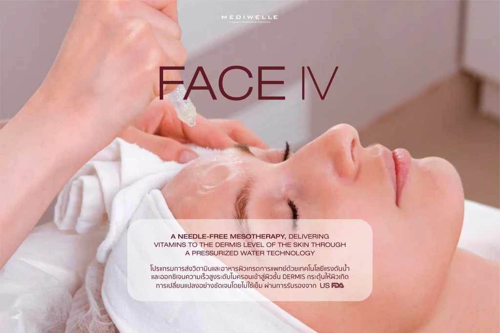 Face IV